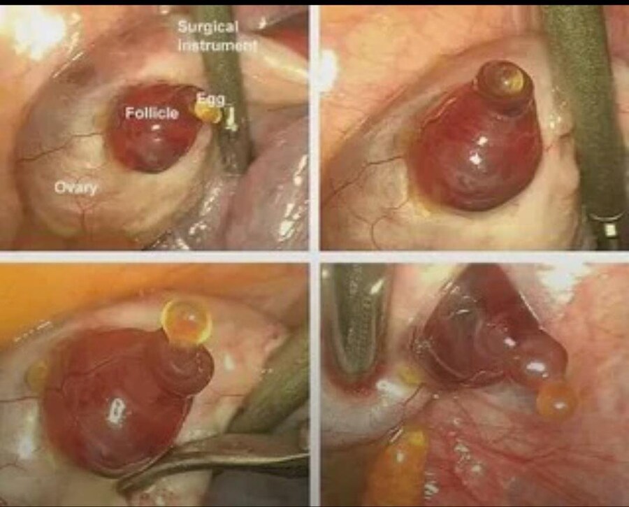 카메라에 포착된 희귀한 인간의 배란 순간_1.jpg