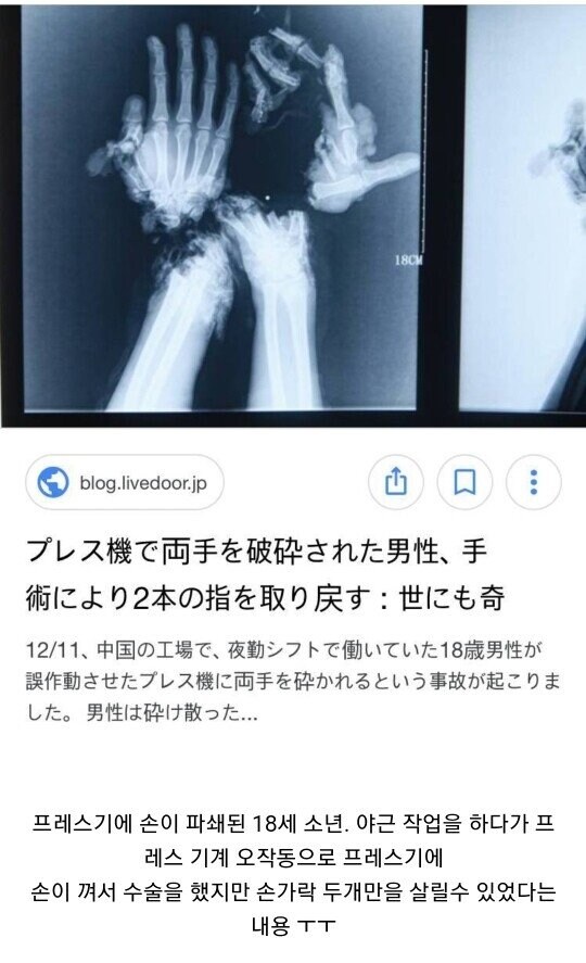 혐] 공장에서 일하다 재수 없으면 인생 훅 가는 이유_2.jpg