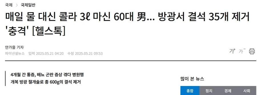 매일 물 대신 콜라 3ℓ 마신 60대 男... 방광서 결석 35개 제거