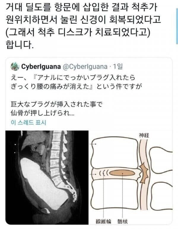 의외로 치료인 행위_1.jpg