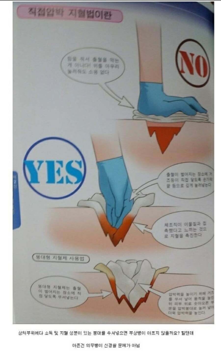 지혈하는데 기절한다고 해도_1.jpg