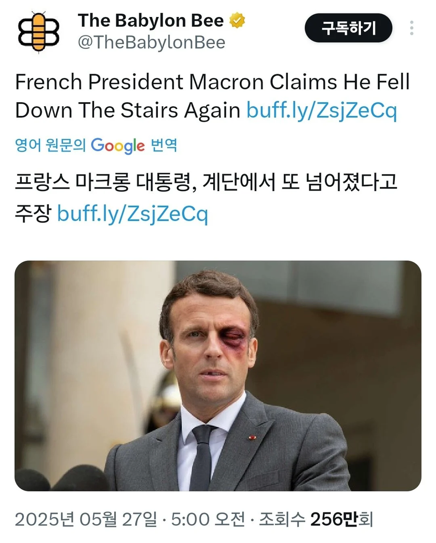 눈탱이 밤탱이 된 마크롱_1.webp