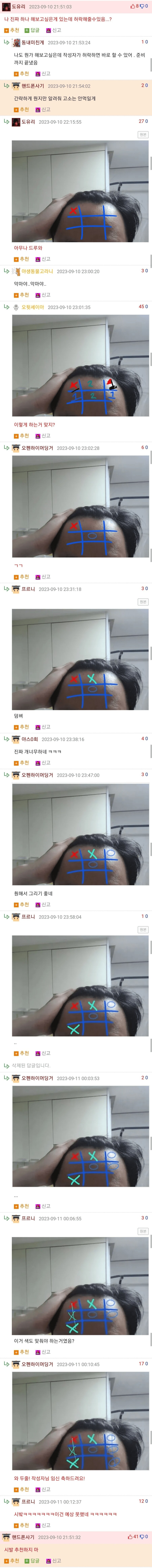 탈모 때문에 고민인 사람.jpg_2.png