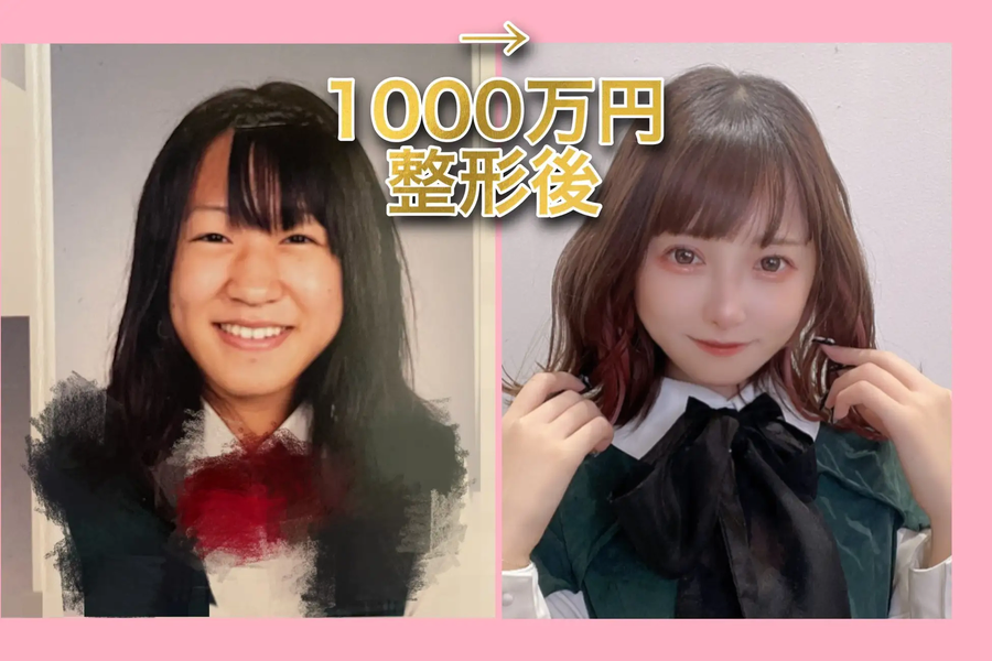1억의 가치_1.webp
