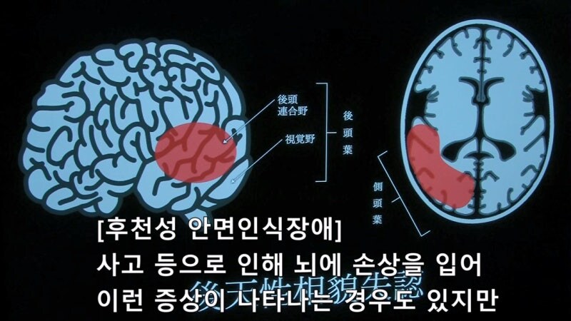 전체 인구의 2%가 갖고있다는 병_14.jpg