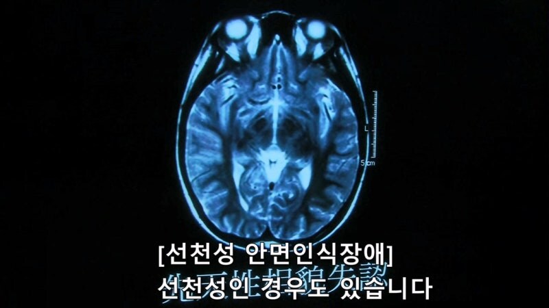 전체 인구의 2%가 갖고있다는 병_15.jpg