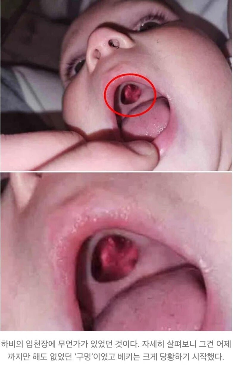 아기 입천장에 구멍이 뚫린 줄 알고 식겁한 엄마.jpg_1.jpg