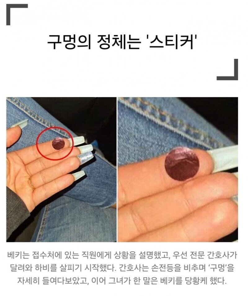 아기 입천장에 구멍이 뚫린 줄 알고 식겁한 엄마.jpg_2.jpg