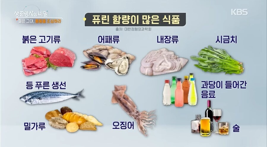 통풍 걸리면 평생 외식 못하는 몸이 되는 이유_1.jpg