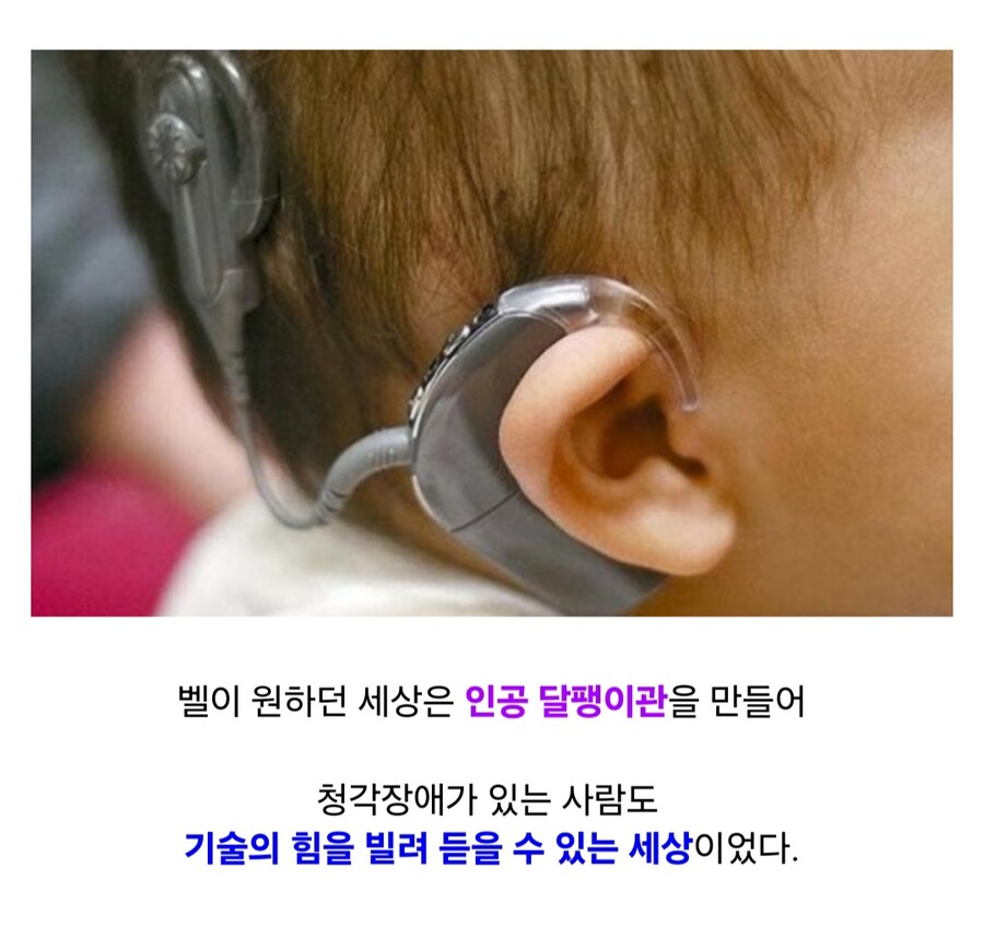 모든 청각장애인을 없애고 싶었던 우생학 지지자_7.jpg