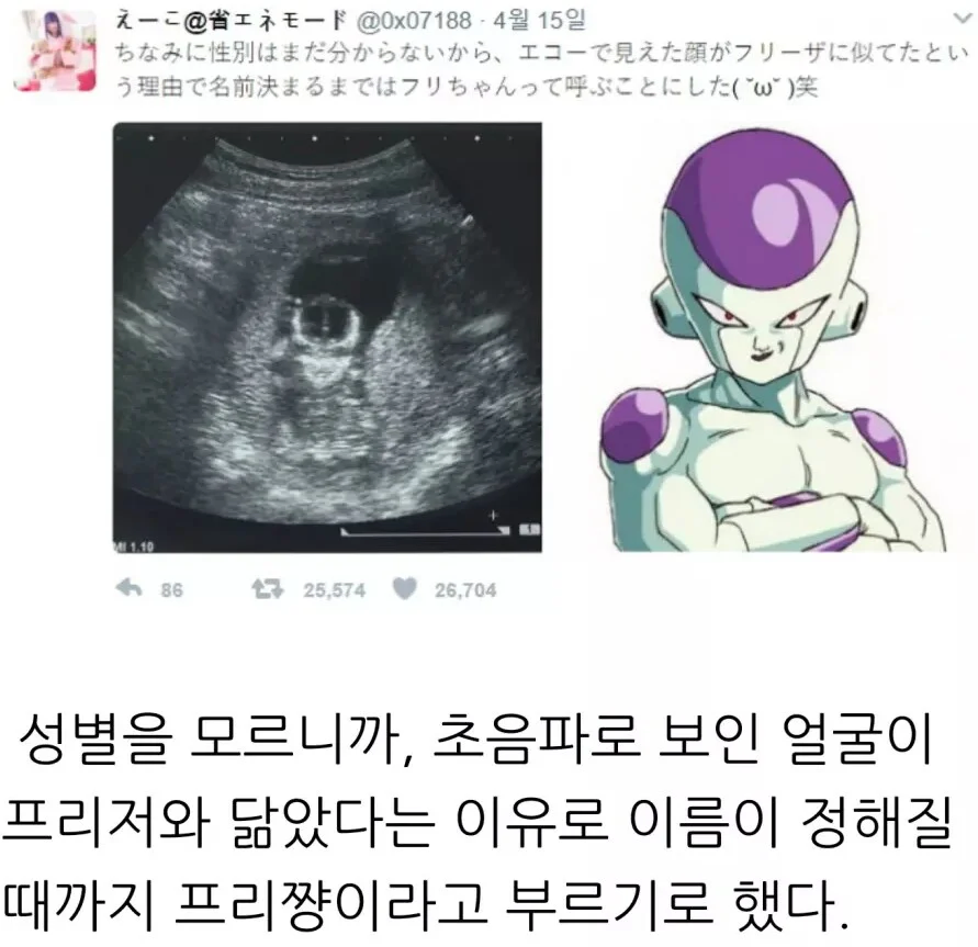 아기의 태명이 프리저인 이유_1.webp