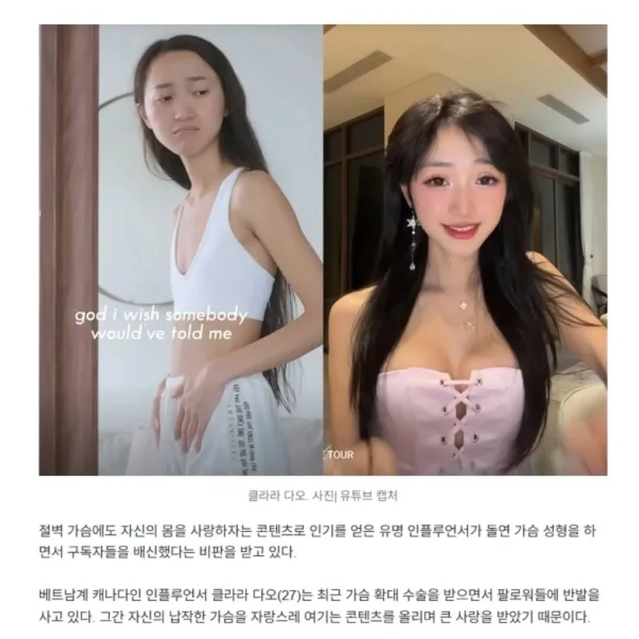 가슴 수술한게 이해가는 유튜버.jpg_1.webp