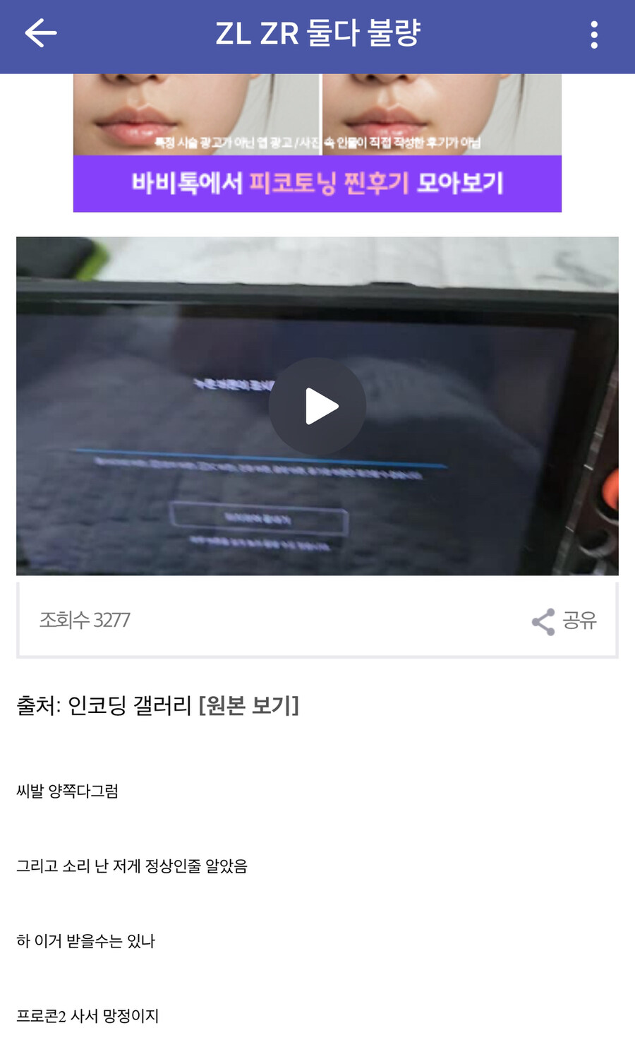 스위치2 자.지 불량 이슈_4.jpg