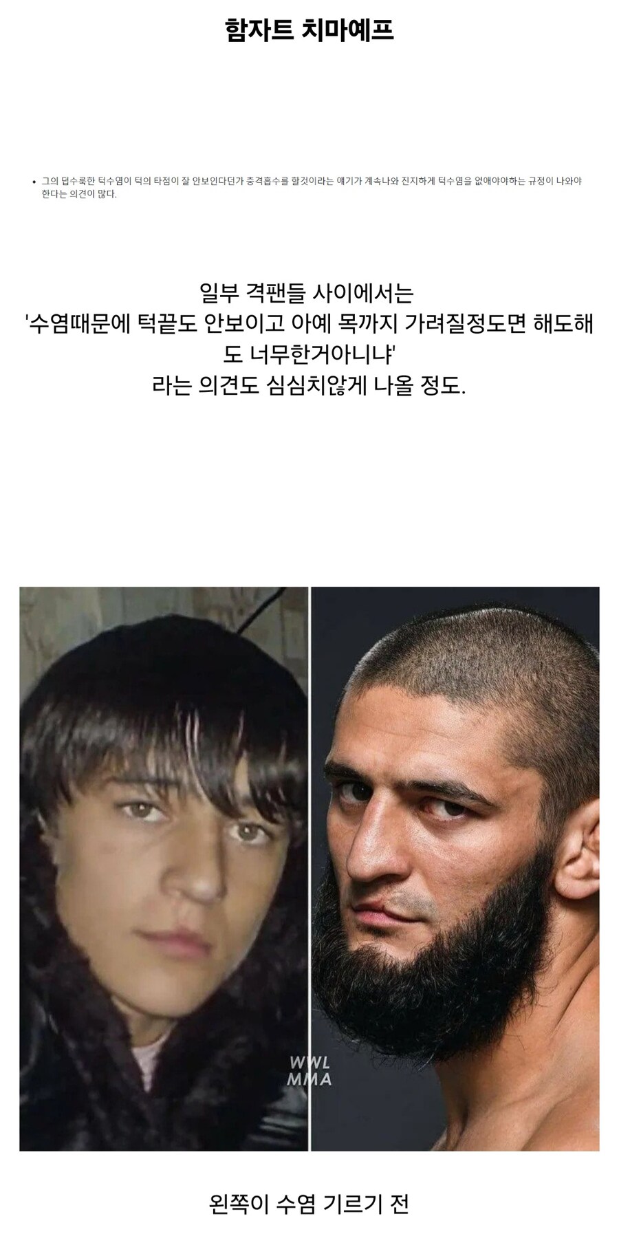 턱에 쿠션 달고있냐는 말이 나오고있는 UFC 선수_4.jpg