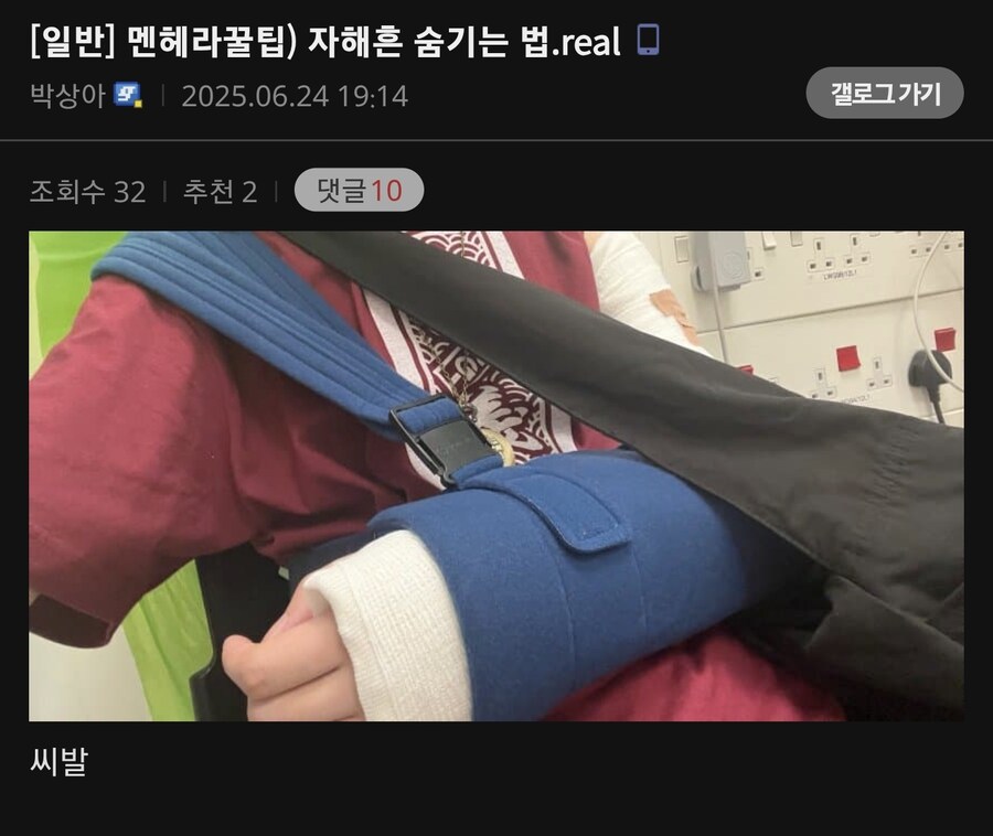 멘헤라꿀팁) 자해흔 숨기는 법.real_1.jpg