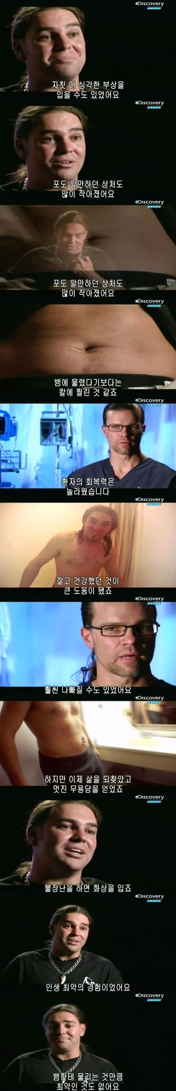 [극혐] 코브라한테 물려 배에 구멍이 뚫린 사람.jpg_11.jpg