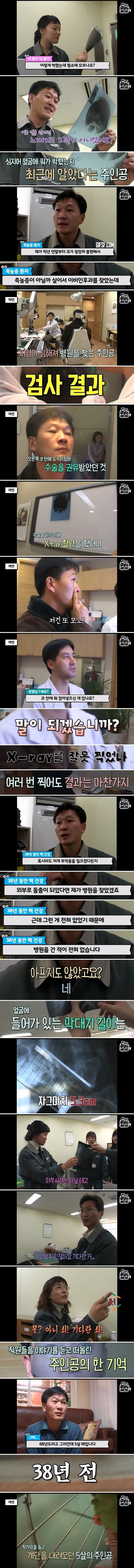 축농증 수술하러 갔다가 나온 물건.jpg_2.jpg