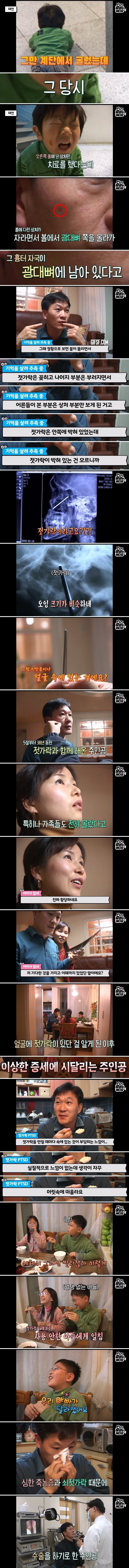 축농증 수술하러 갔다가 나온 물건.jpg_3.jpg