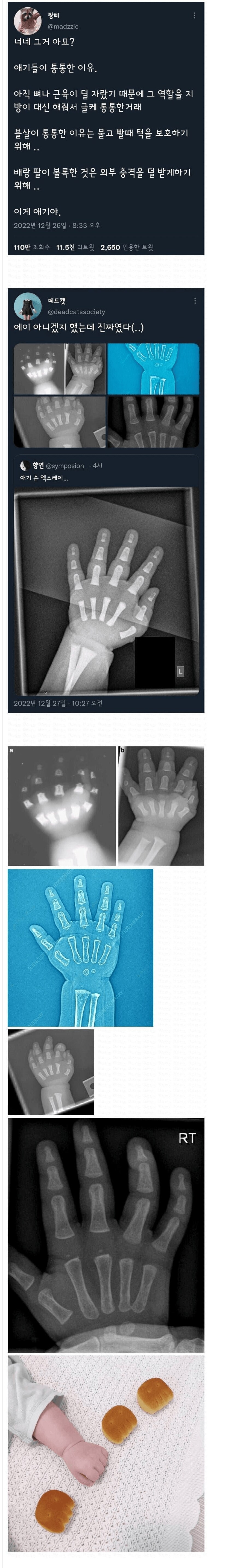 애기들이 통통한 이유.jpg_1.png
