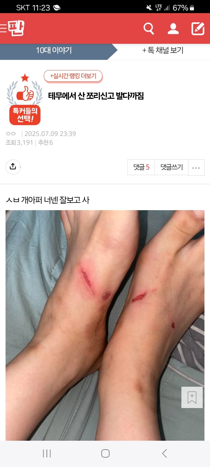 쪼리 신고 발이 ㅆㅊ난 10대 판녀_1.jpg