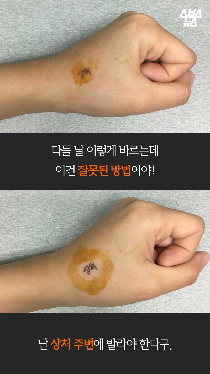 빨간약을 상처 주위에 발라야한다고 안 사람이 많았던 이유.jpg_3.jpg