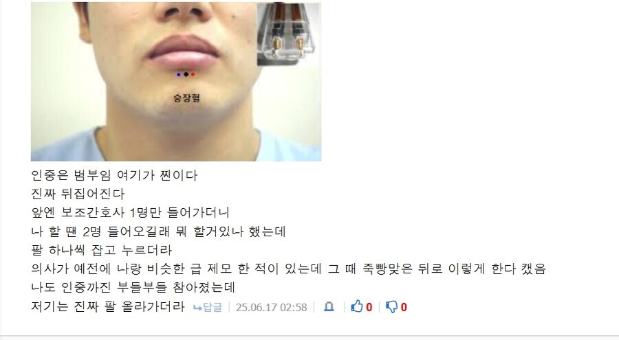 피부과에서 시술할 때 환자를 결박하는 이유_2.png