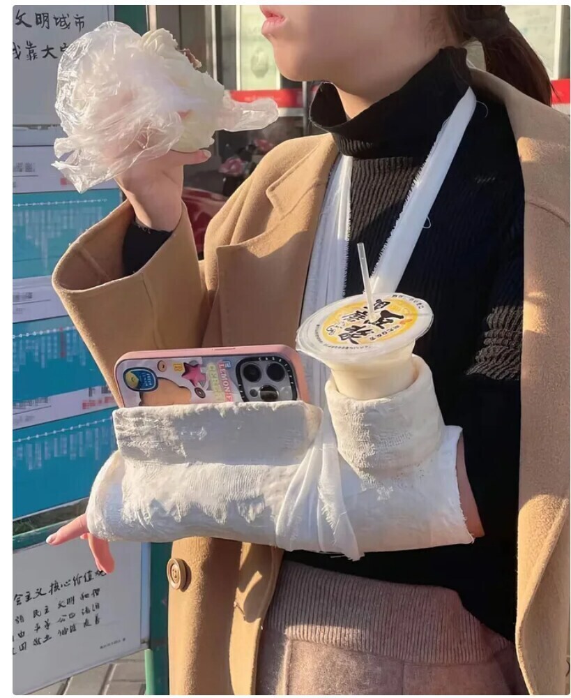 팔 다친 거 깁스라도 효율적으로 써 보자구_1.jpg
