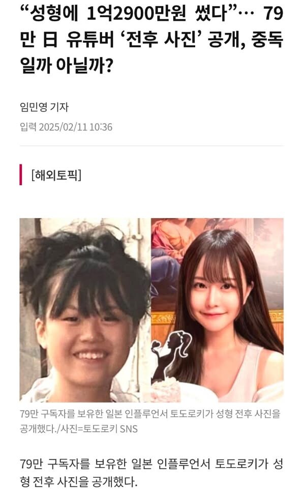 성형에 1억2900만원 쓴 일본유튜버.jpg_1.jpg