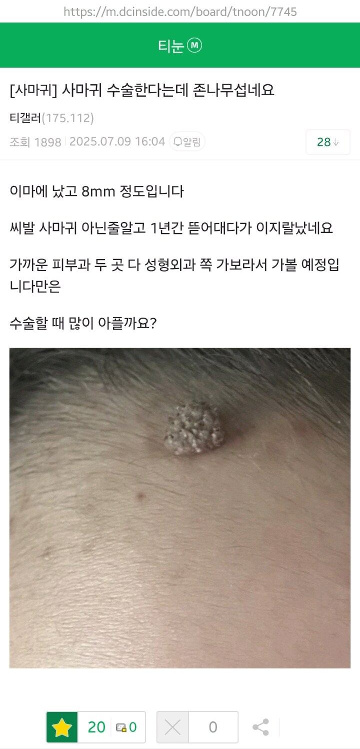 티눈갤 유니콘_1.jpg
