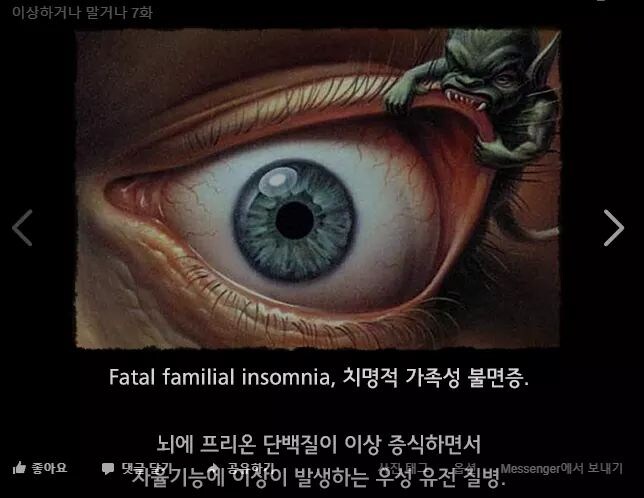 한번 발병하면 죽을때까지 잠을 잘 수 없는 병_1.jpg