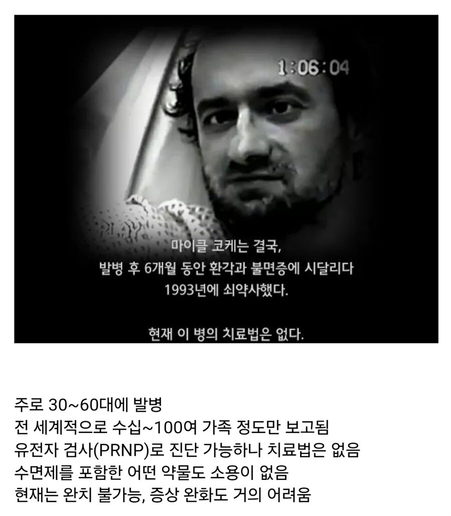 한번 발병하면 죽을때까지 잠을 잘 수 없는 병_9.jpg