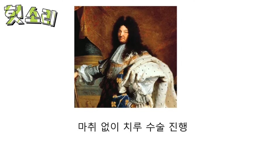 인자강 그 자체였던 루이 14세.jpg_12.png