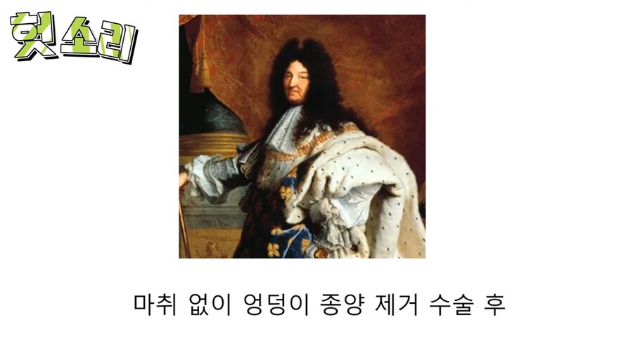 인자강 그 자체였던 루이 14세.jpg_14.png