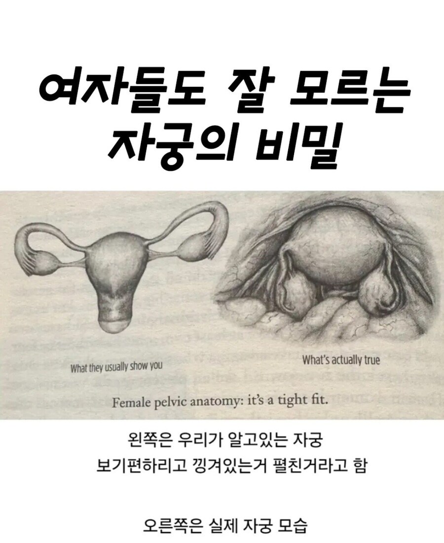 사람들이 잘 모르는 실제 자궁 모습_1.jpg