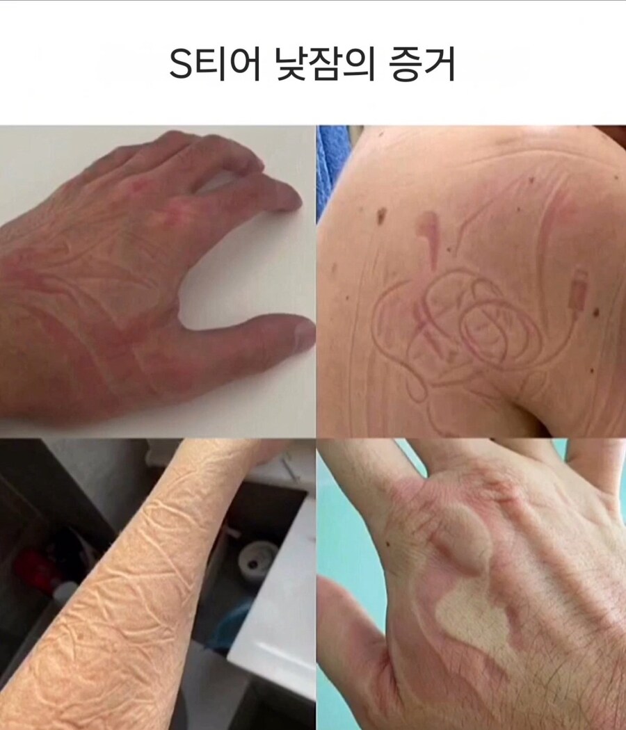 S티어 낮잠의 증거_1.jpg