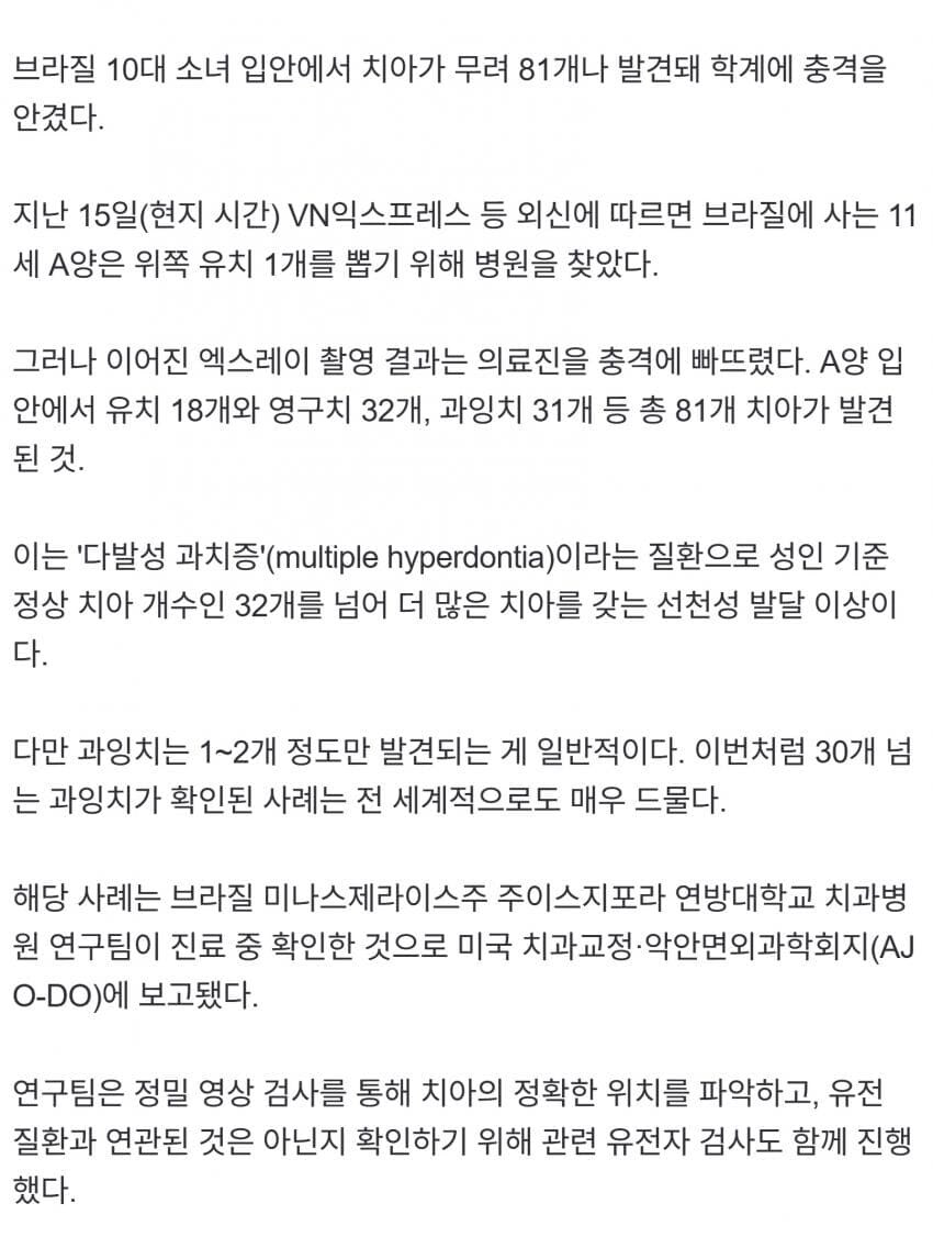 이빨많은 브라질 소녀_2.jpg