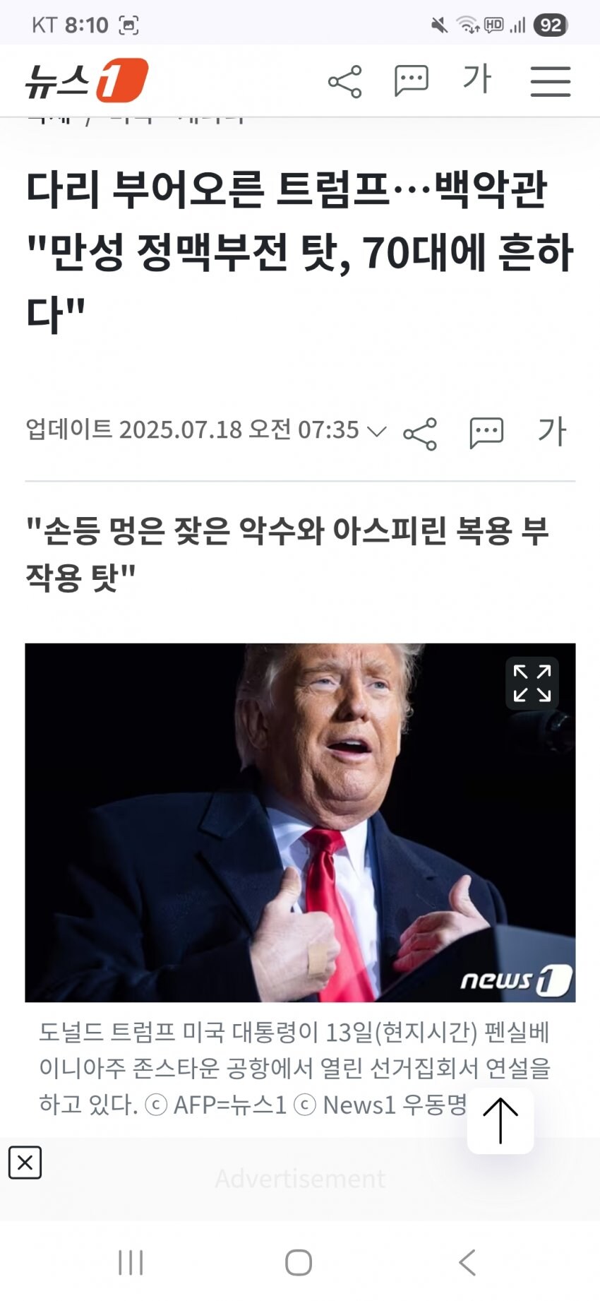 트럼프, 만성 정맥부전증 진단_1.jpg