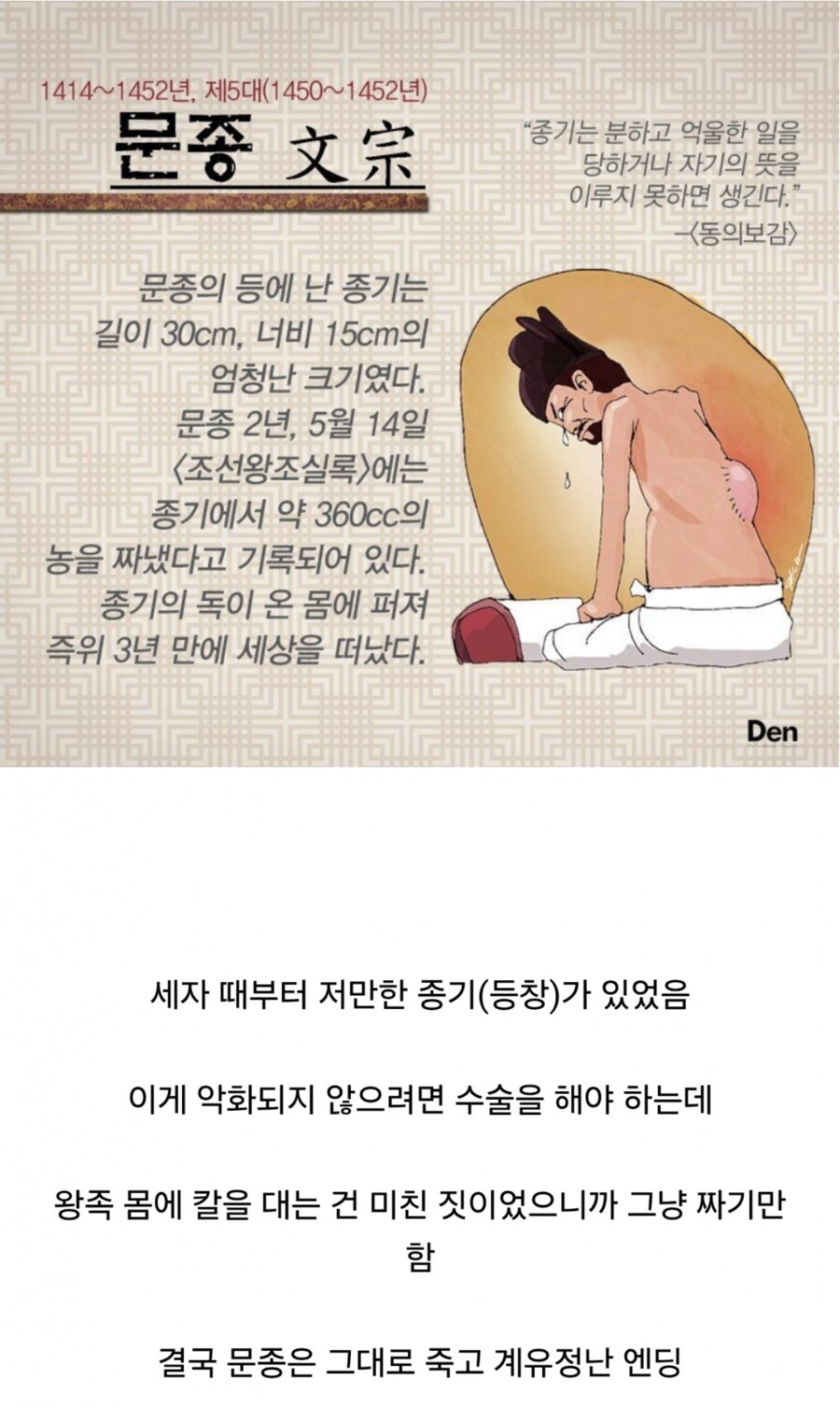 문종의 등에 있던 종기 크기.jpg_1.jpg