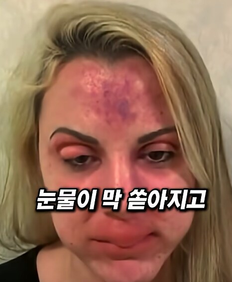 알레르기 환자에게 땅콩 들어간 도시락... 소송 결과는??_13.png