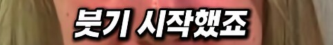 알레르기 환자에게 땅콩 들어간 도시락... 소송 결과는??_14.png