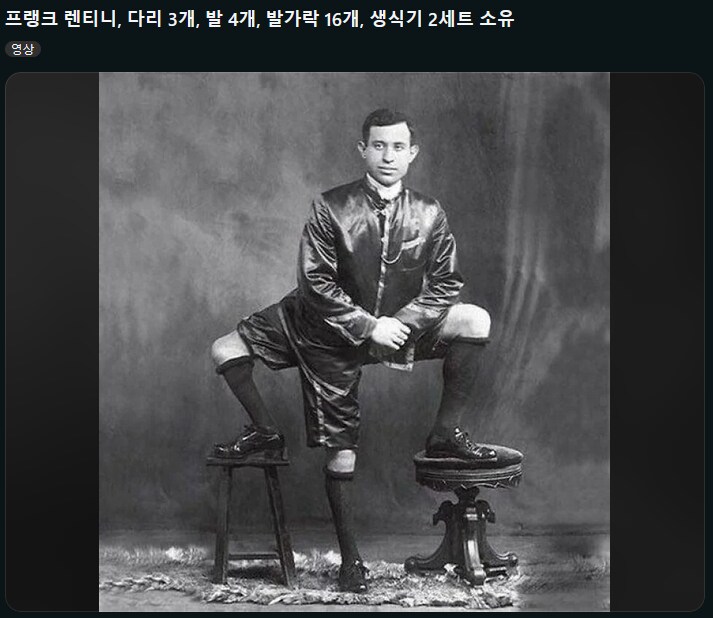 인류 역사상 가장 급진적인 도전을 한 돌연변이_1.png
