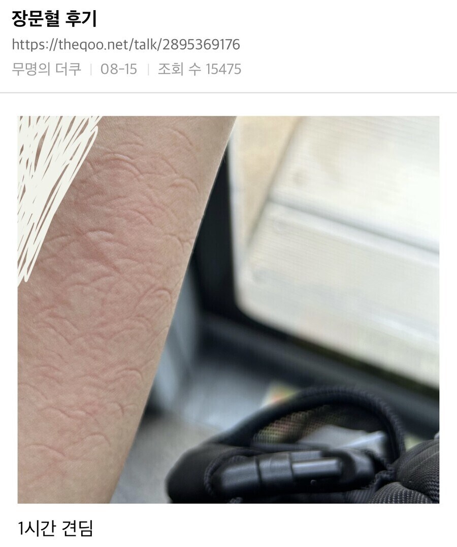 급똥막는 장문혈 후기_1.jpg
