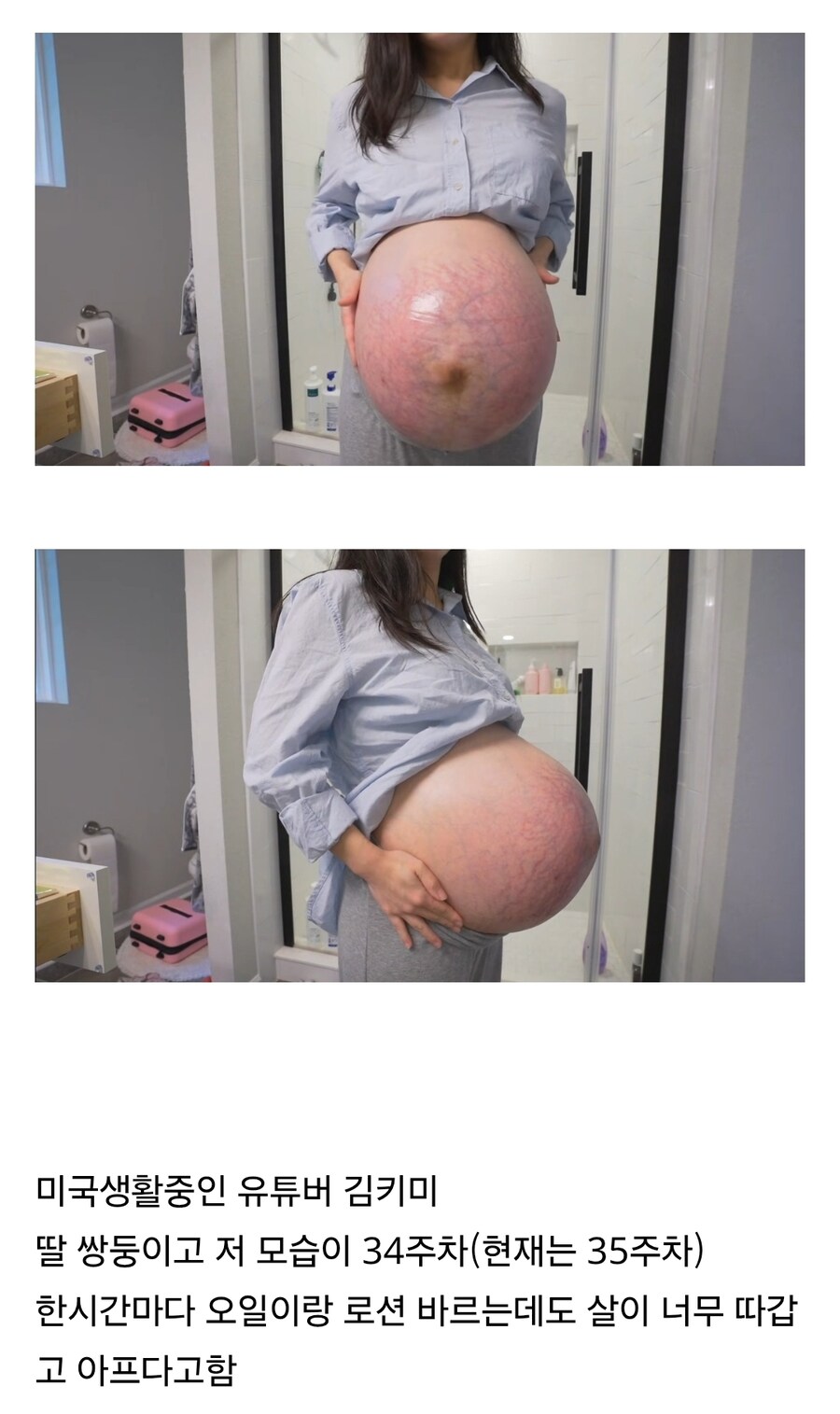 쌍둥이 임신 34주차라는 유튜버 배 크기_1.jpg