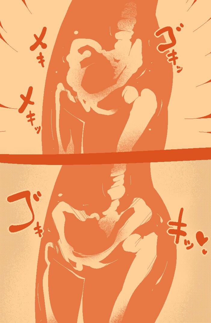 ts중 인체의 변화_1.jpg