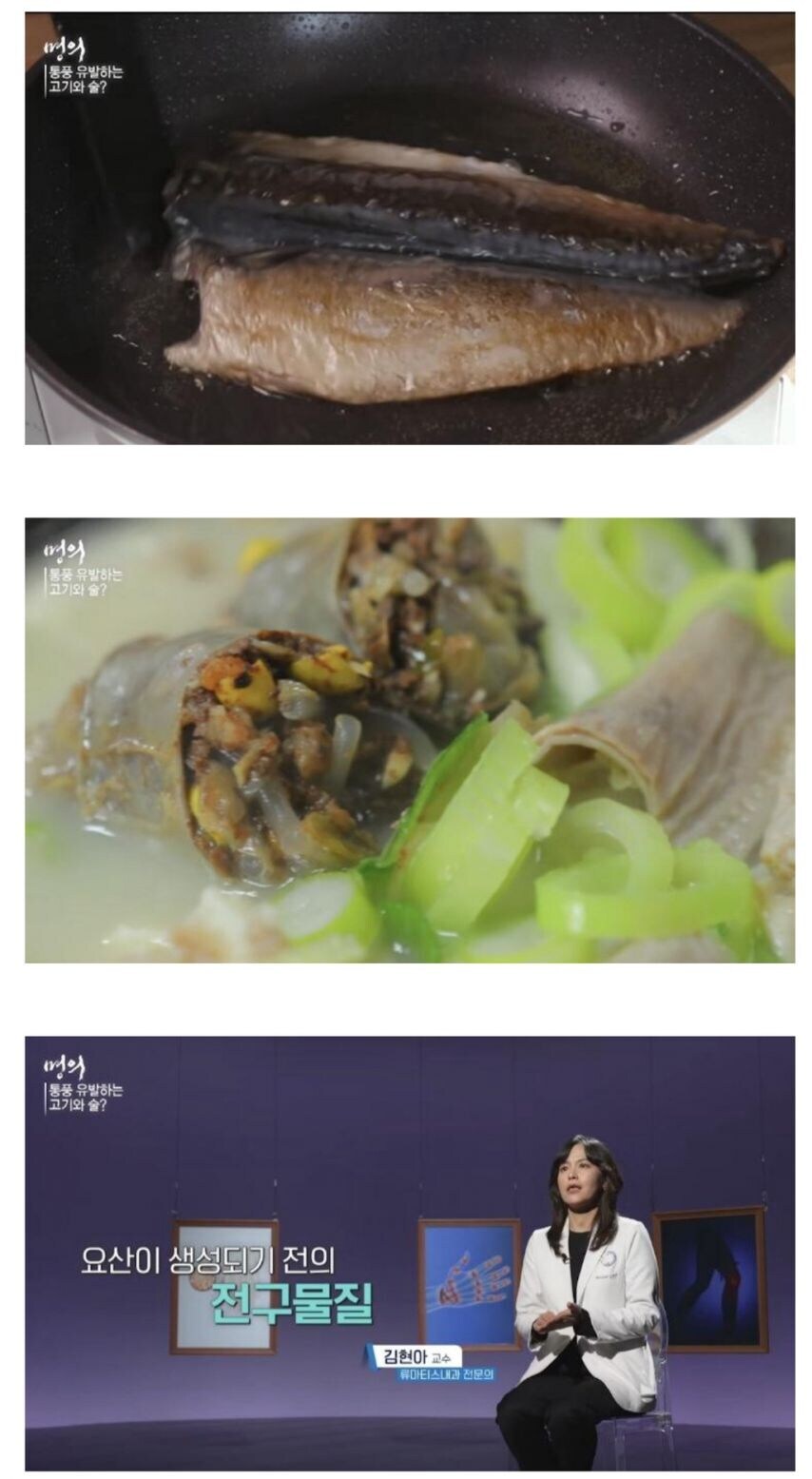 통풍 환자가 증가하는 이유_1.jpg