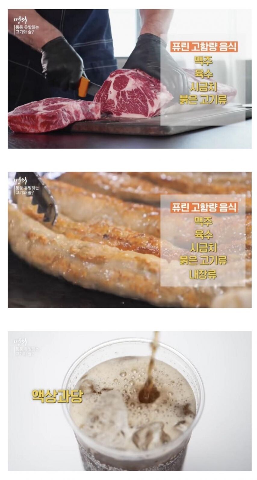 통풍 환자가 증가하는 이유_4.jpg