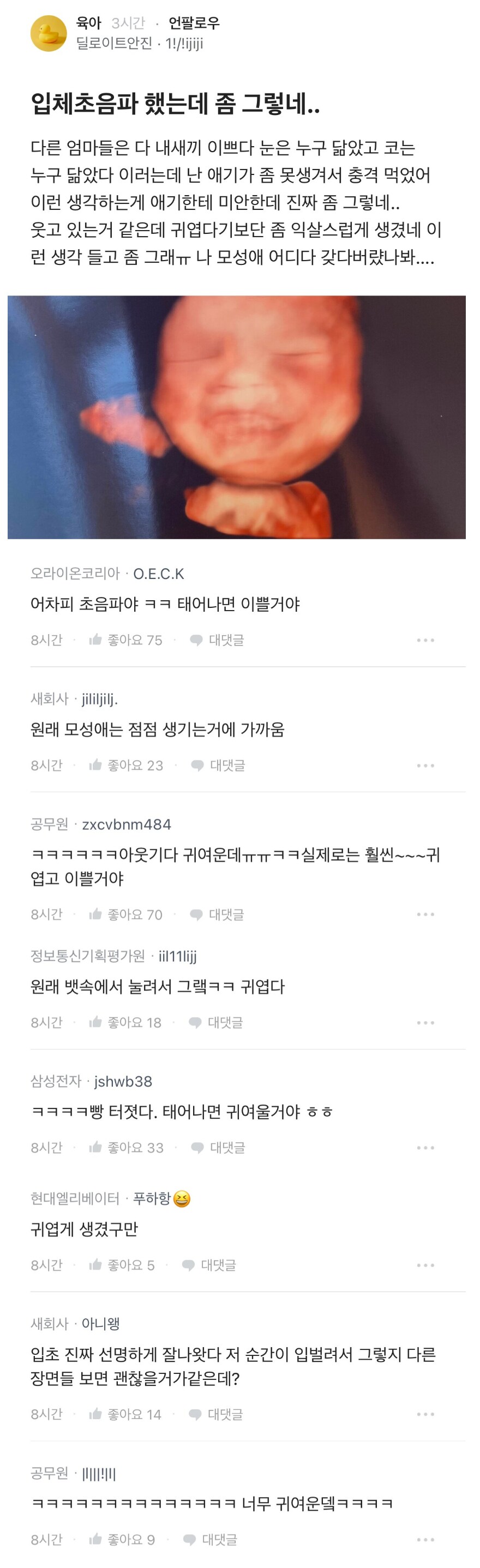 입체 초음파 했는데 좀 그러네_1.png