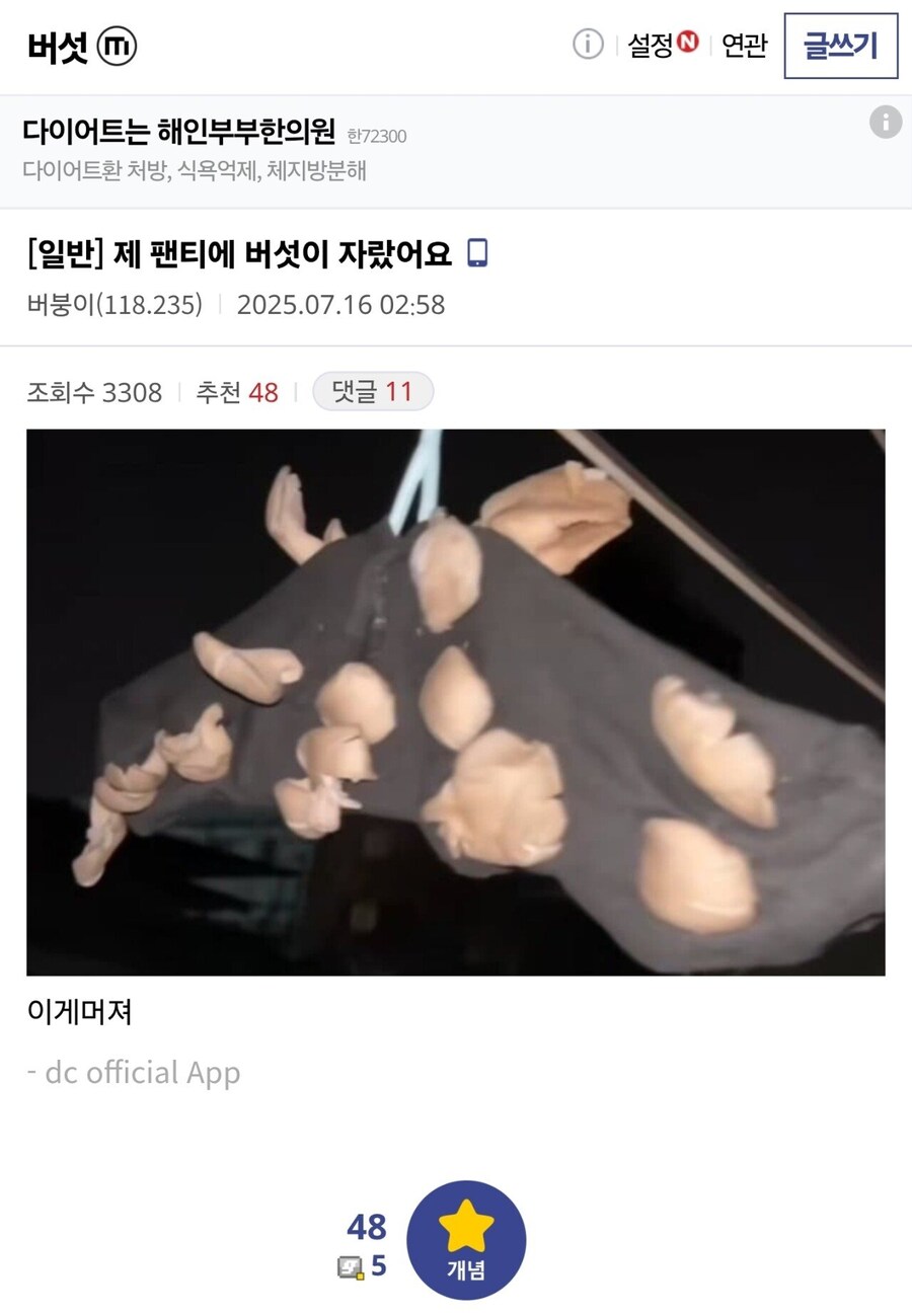 팬티에서 버섯이 자라났다는 버섯갤러_1.jpg