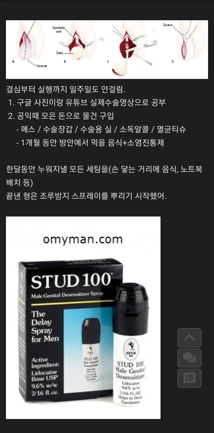 사촌형이 고자가 된 사연.._2.jpg