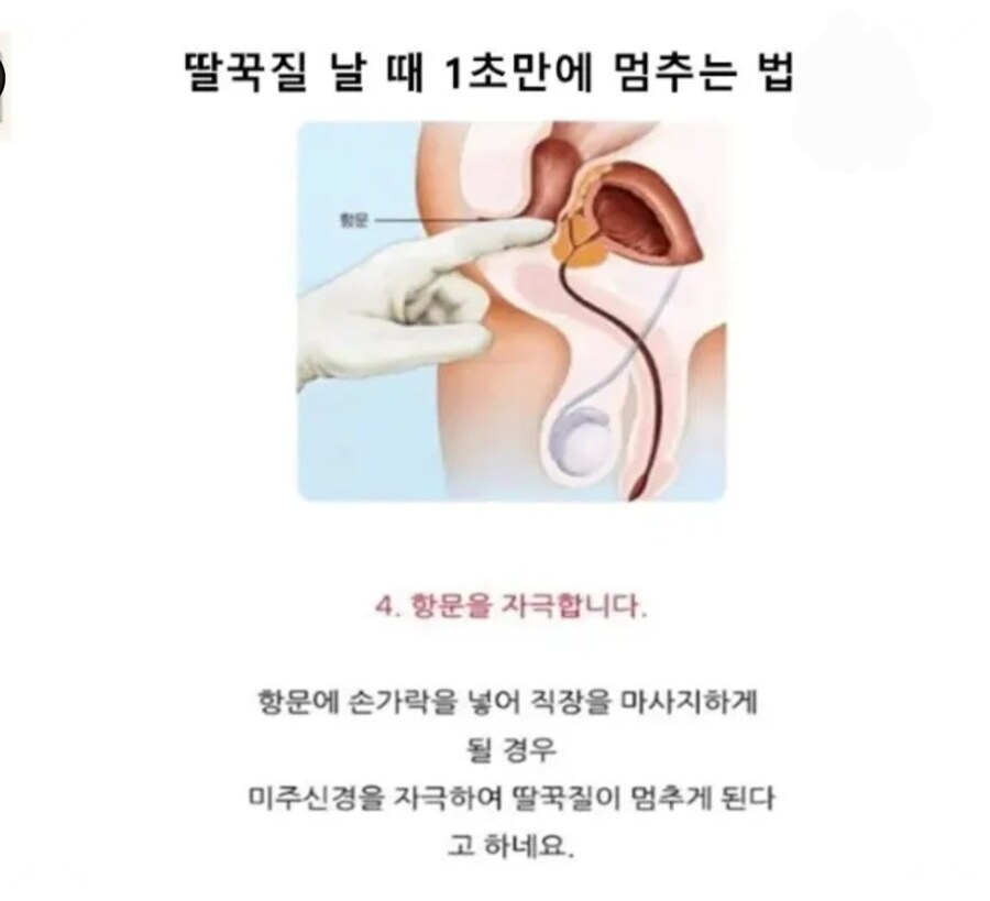 딸국질 하는 방법아는사람있음?_1.webp